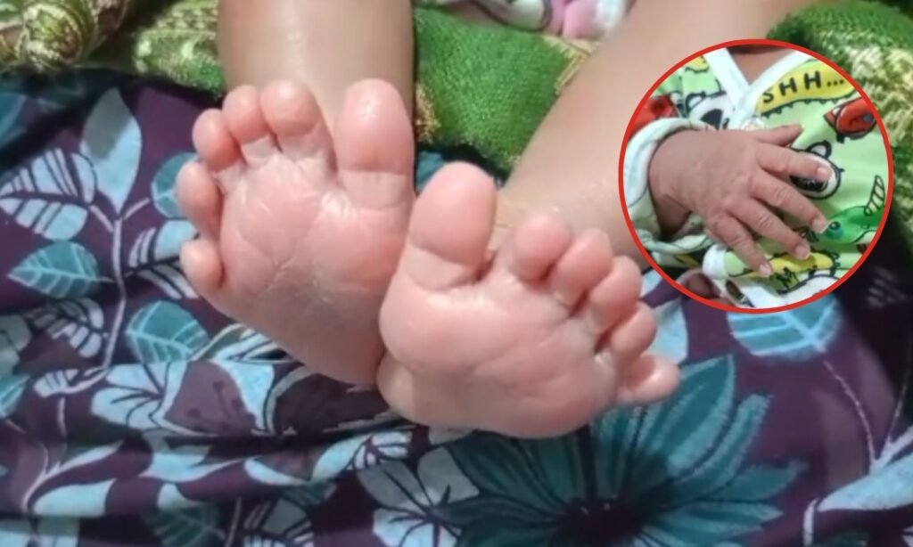 Betul Newborn 24 Fingers