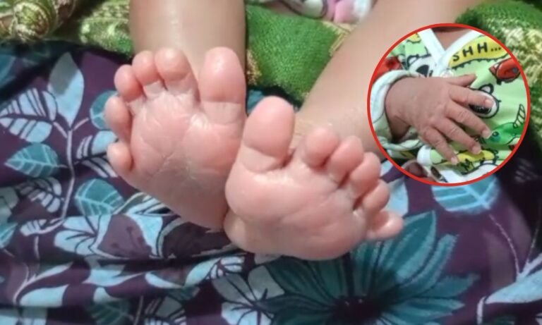 Betul Newborn 24 Fingers