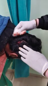 Bhopal MBBS student assault viral video